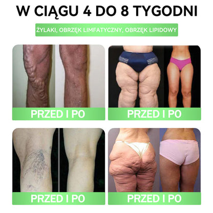🧡 Ciesz się 50% rabatem, dodając drugi produkt - GFOUK® Moringa